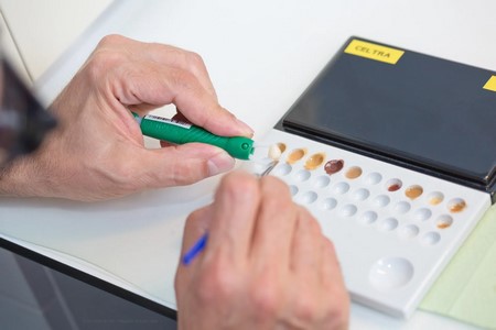 cerec-keramiksystem-bild-4