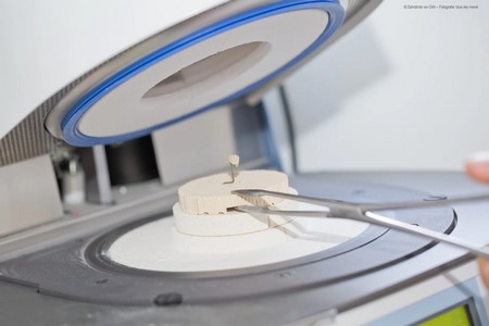 cerec-keramiksystem-bild-6