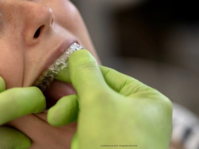alignertherapie-bild-3-1920w-vorschau.jpg